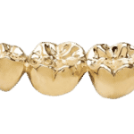 sell dental gold in Palm Harbor, Florida